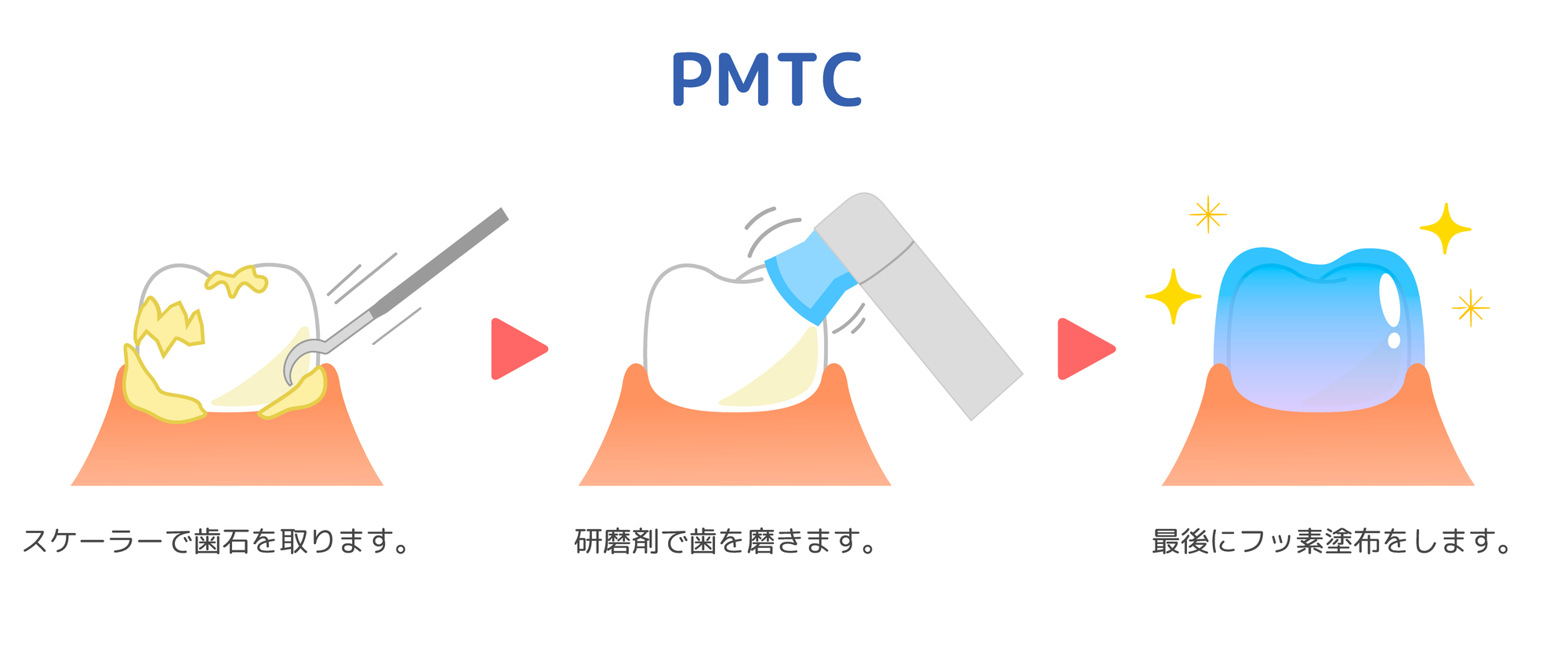 図：PMTCのイメージ